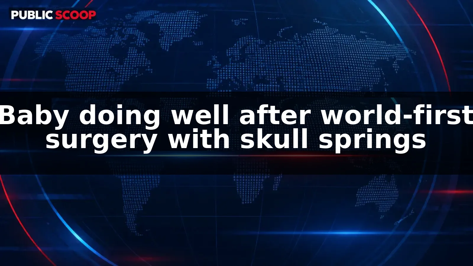 Baby doing well after world-first surgery using super-elastic skull springs